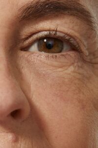 بهترین روتین پوستی برای پوست خشک