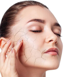 بهترین روتین پوستی برای پوست خشک